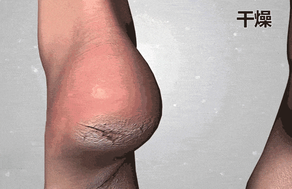 试这个外抹的方子一试就灵不朽情缘手足干裂的人试(图15)