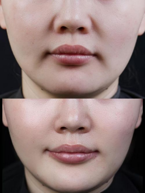 榜前十名公认有效的抗皱产品汇总分析不朽情缘app抗衰老的护肤品排行